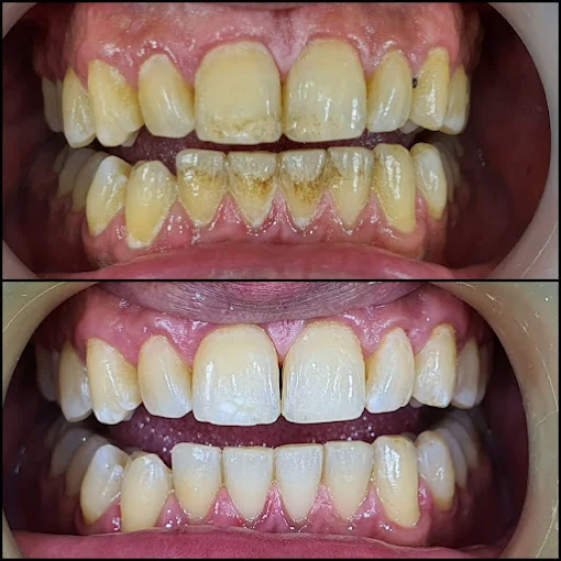 Cabinet dentaire Agdal