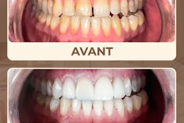 Centre Dentaire Dr Benchekroun Salma