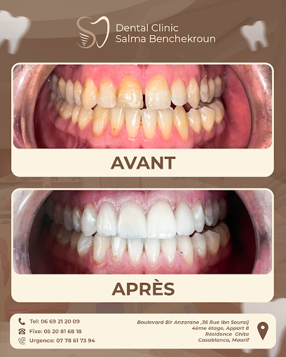Centre Dentaire Dr Benchekroun Salma