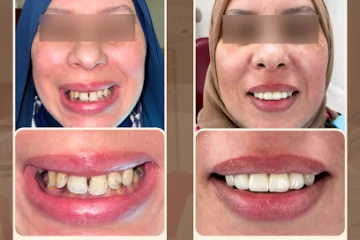 Centre Dentaire Dr Benchekroun Salma