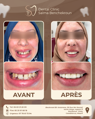 Centre Dentaire Dr Benchekroun Salma